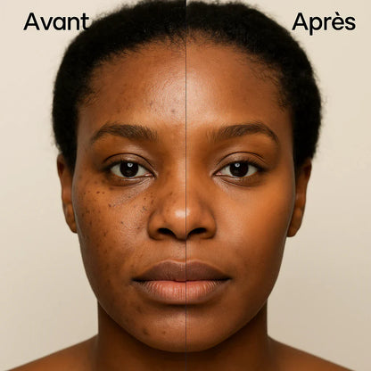 Nettoyant visage au curcuma™️ 5000cfa